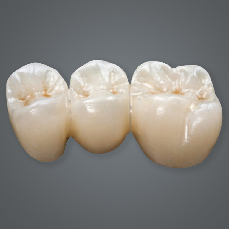 Monolithic Zirconia