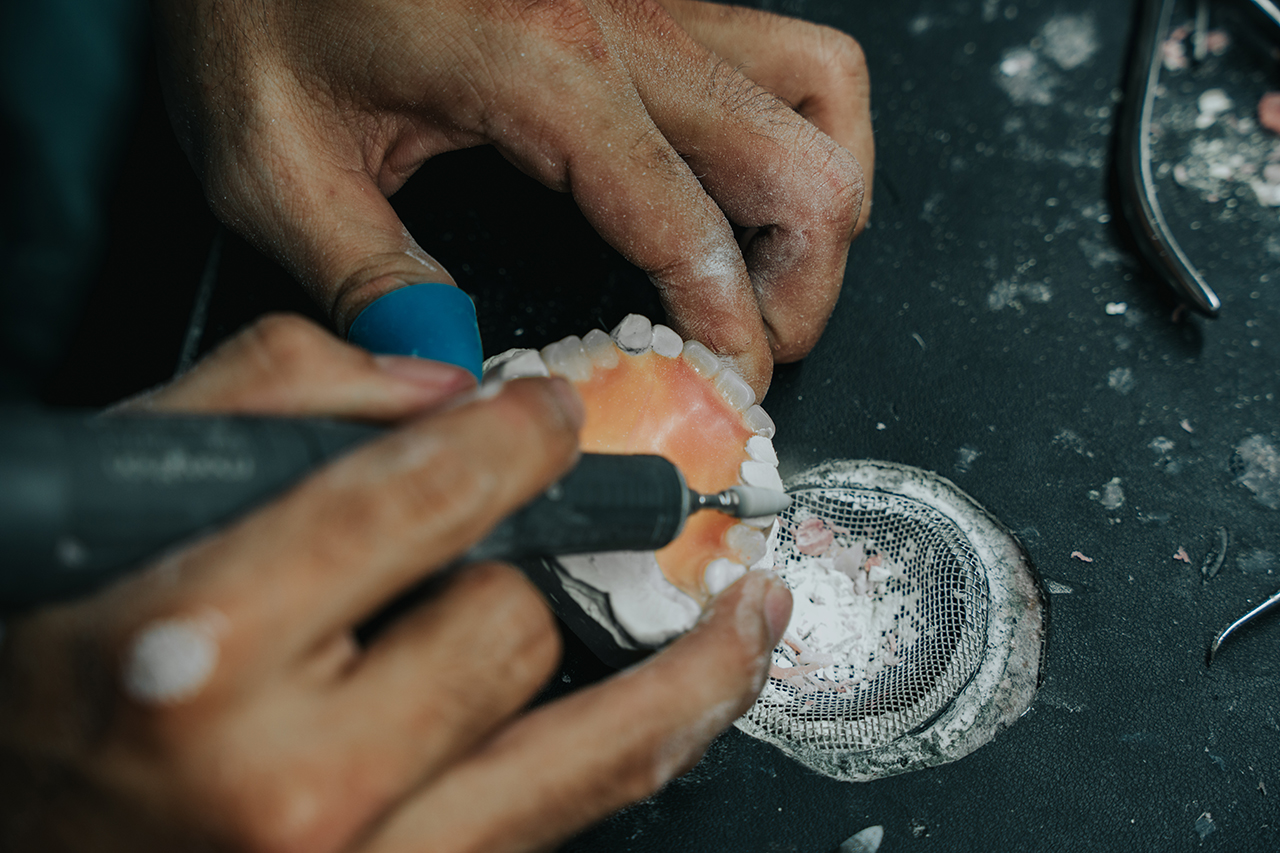 Benefits for U.S. Clinics Partnering with XDENT LAB Benefits for U.S. Clinics Partnering with XDENT LAB