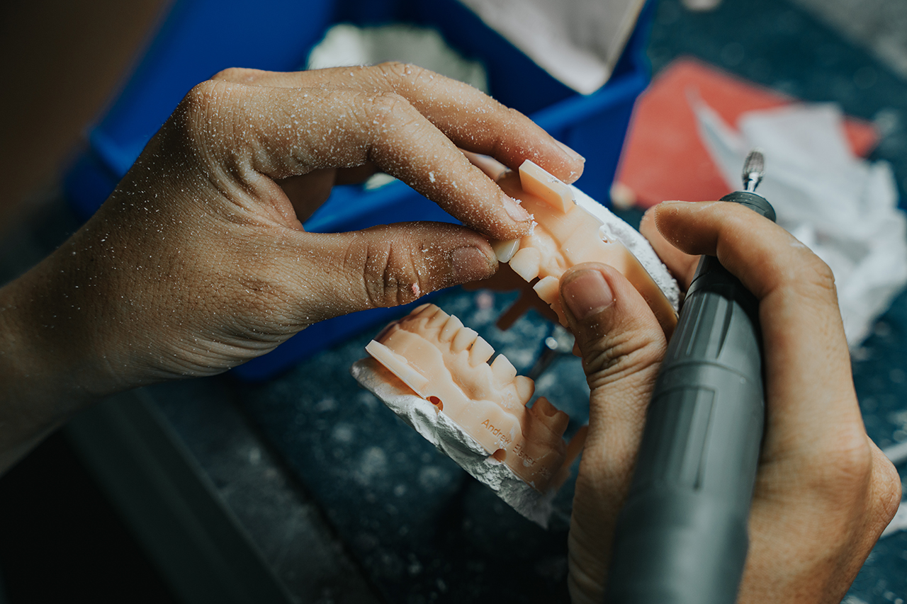 vietnam-dental-lab