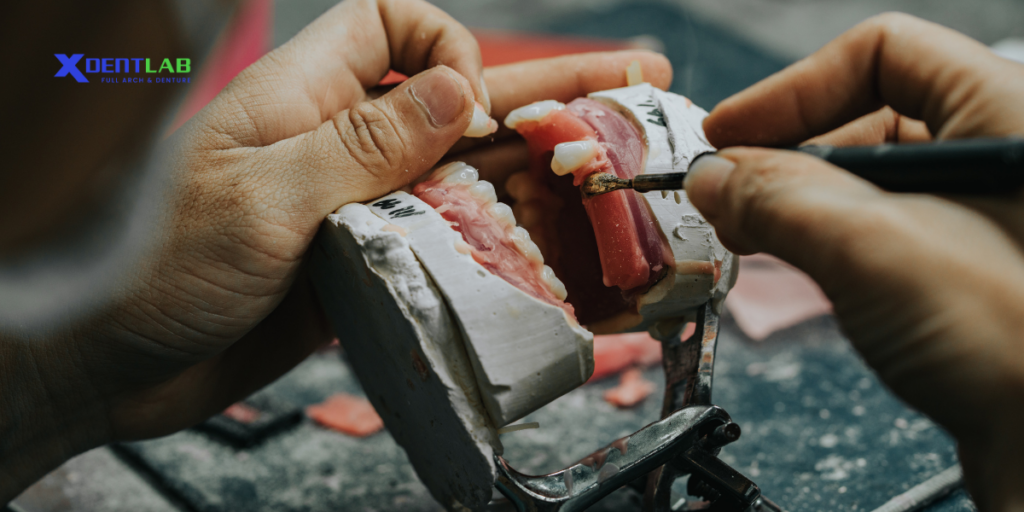 XDENT LAB – A Trusted Vietnam Dental Partner XDENT LAB – A Trusted Vietnam Dental Partner