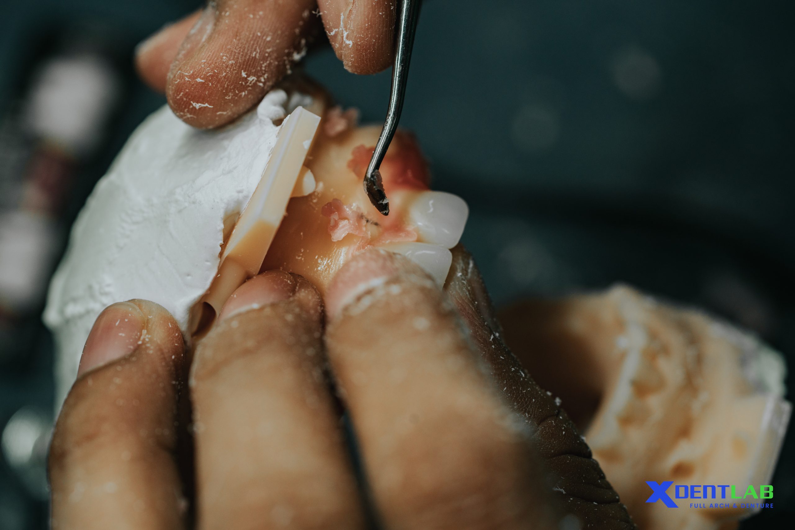 Choosing the Right Partner: XDENT LAB Vietnam Dental Lab Choosing the Right Partner: XDENT LAB Vietnam Dental Lab