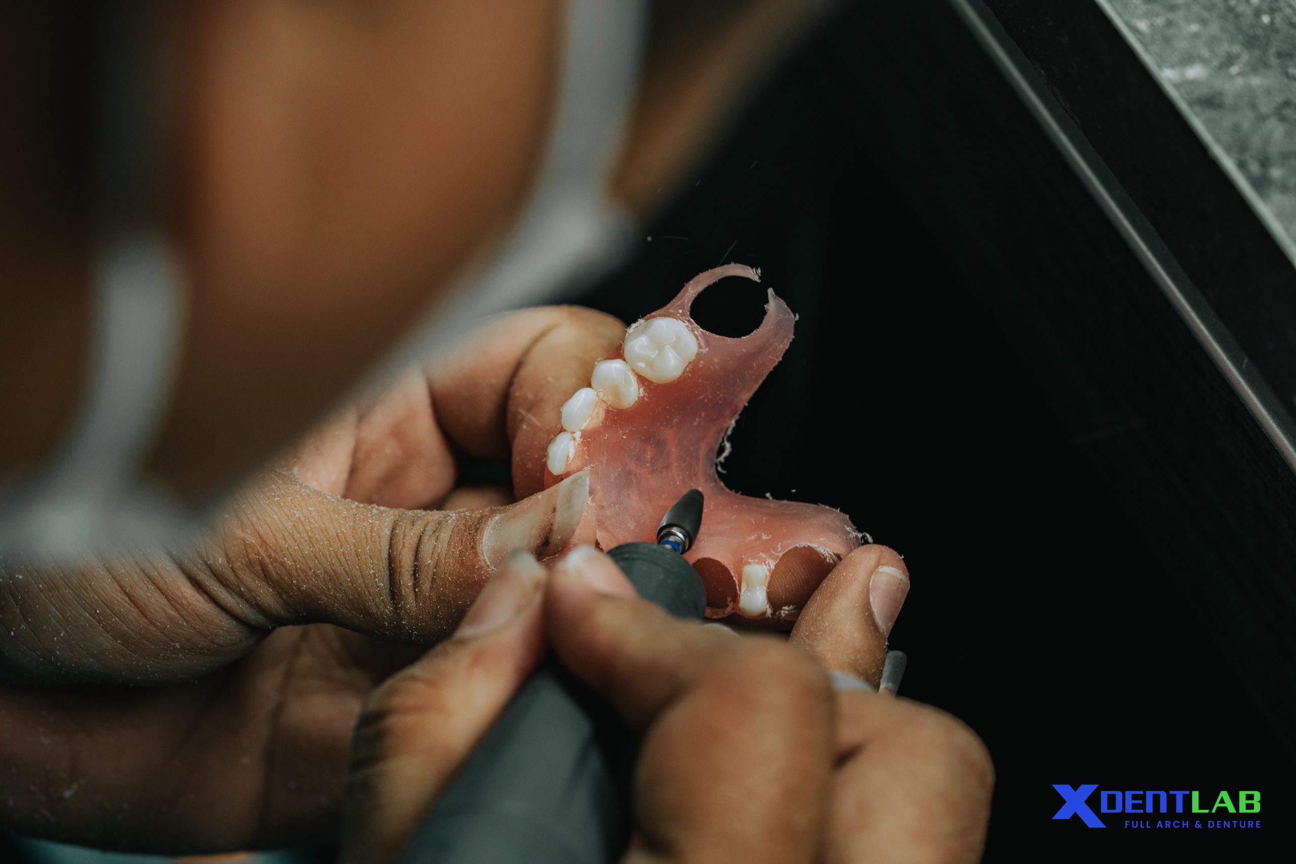 Types of Full Arch Cases Are Ideal for Outsourcing Types of Full Arch Cases Are Ideal for Outsourcing