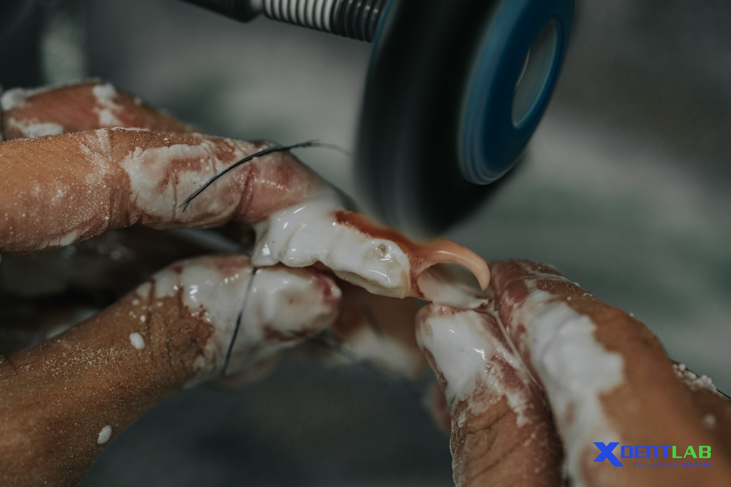 Everything You Need To Know About XDENT Full Arch Outsourcing Vietnam Everything You Need To Know About XDENT Full Arch Outsourcing Vietnam