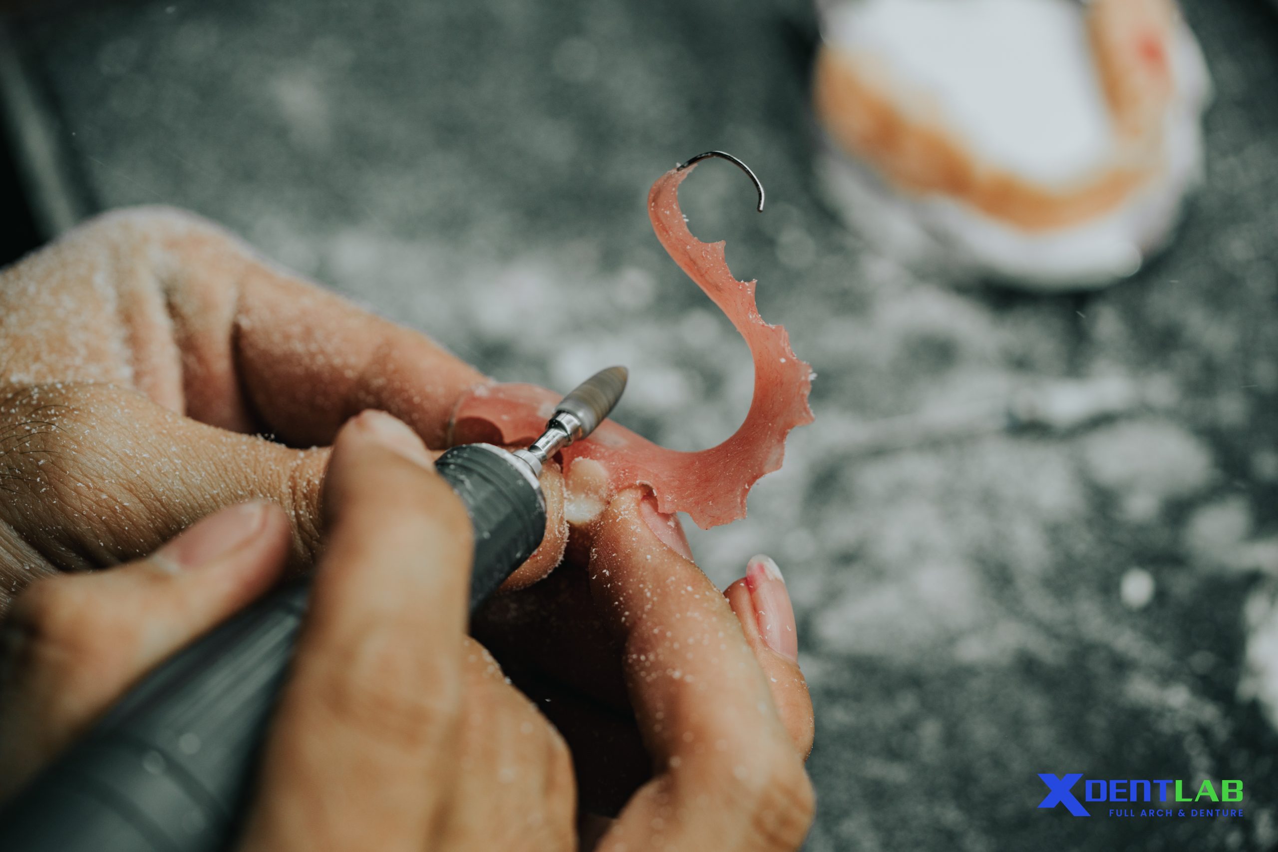 XDENT Apart in Full Arch Outsourcing XDENT Apart in Full Arch Outsourcing