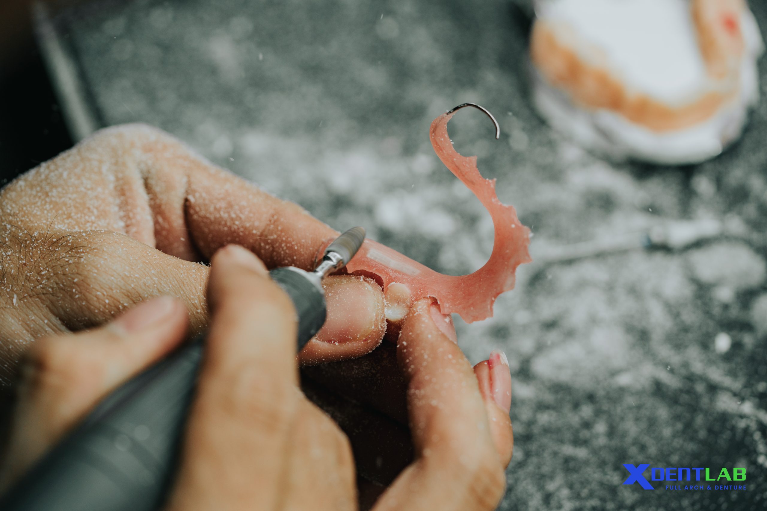 Results that Build Confidence - XDENT LAB Results that Build Confidence - XDENT LAB