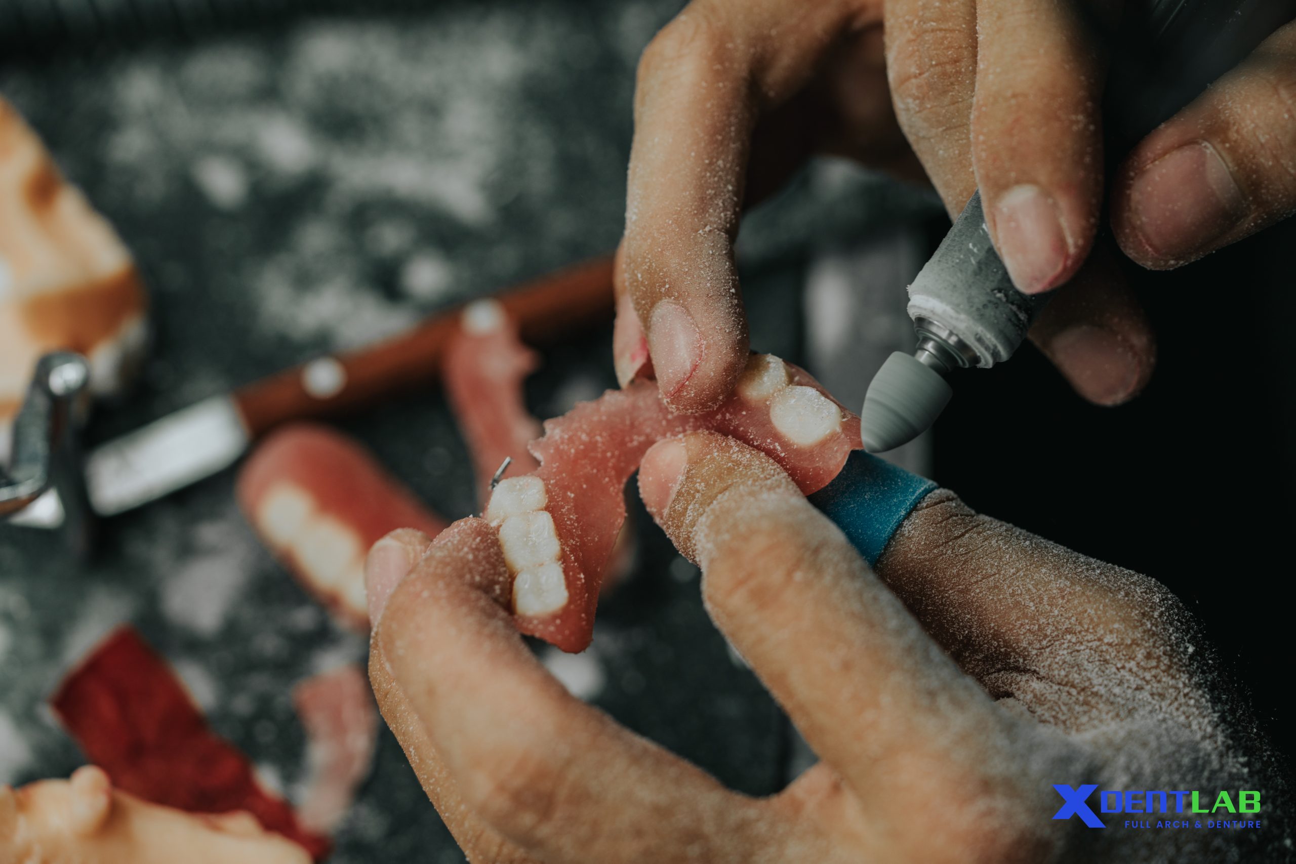 The XDENT LAB Advantage The XDENT LAB Advantage