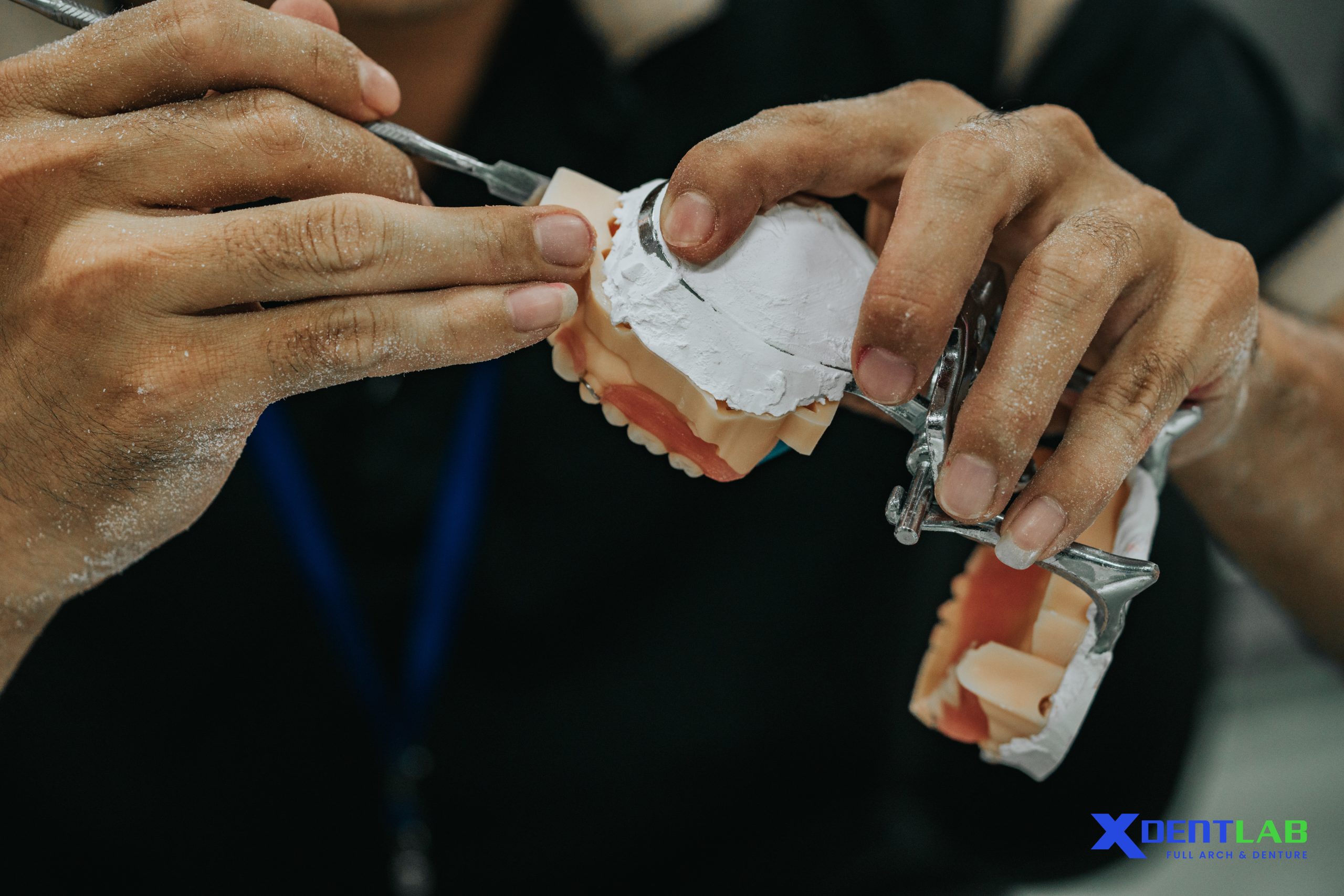 Everything About Outsource All-On-4 Dental Cases For Dental Labs Everything About Outsource All-On-4 Dental Cases For Dental Labs